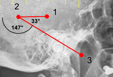 upload/1601478601-40948-angle.jpg